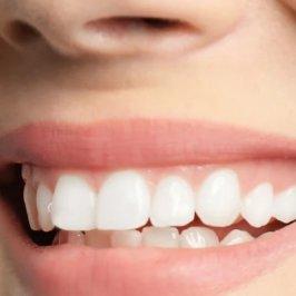 Dental Assistant