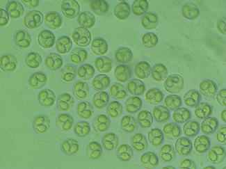 cells in microscope