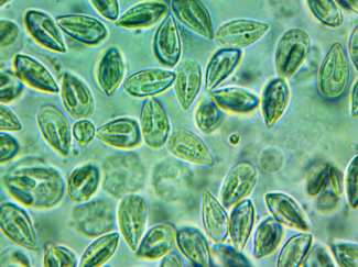 fish parasites under microscope